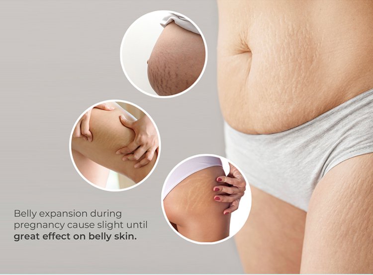 MOOIMOM Belly Lotion description image
